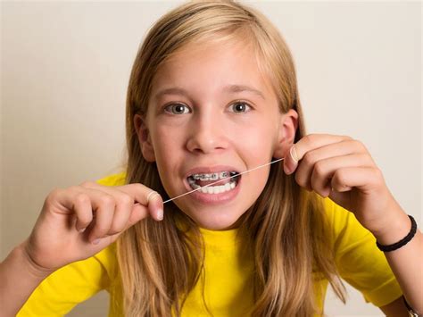 If You’re Wearing Braces, Here Are Some Tips For Flossing | Parkland ...