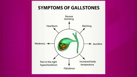Symptoms of Gallstones - YouTube
