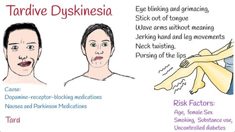 Tardive dyskinesia Causes, Symptoms and Treatment - YouTube