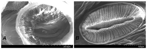 Spiracle with atrial structure. A. Caterpillar in first instar L1; B.... | Download Scientific ...