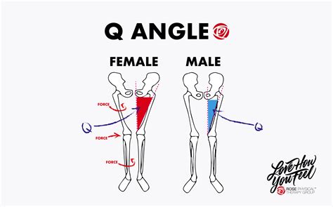 Q Angle Measurement