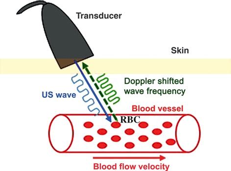 Doppler principle. The Doppler shift (Δf) can be calculated as... | Download Scientific Diagram