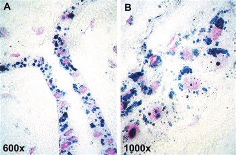 Sudan Black B staining of lipid particles in term labor fetal membranes... | Download Scientific ...