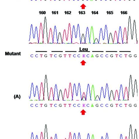 The mutation in the ABCD1 gene is hemizygous c.488G>T (p.Arg163Leu) in ...