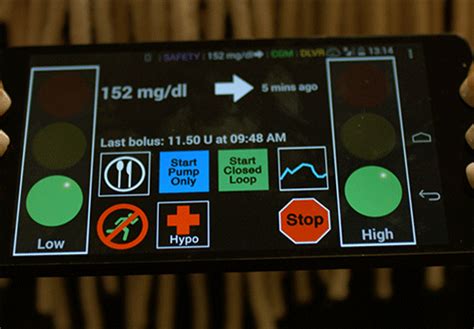 UVA Research: The Artificial Pancreas App