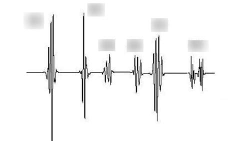 Diagram of Phonocardiogram | Quizlet