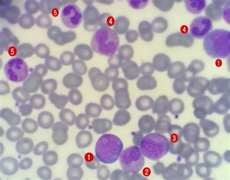 VETERINARY HEMATOLOGY DEXTERVET: 1.Myeloblast,2.metamyelocyte,3.myelocyte,4.band neutrophi ...