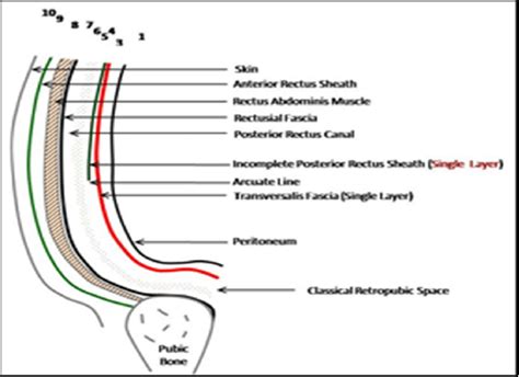 Boundaries of the classical retropubic space (Retzius) in presence of a ...