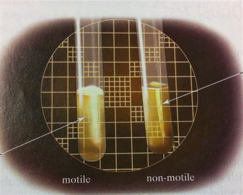 Franciscan Microbiology Lab: Motility Testing