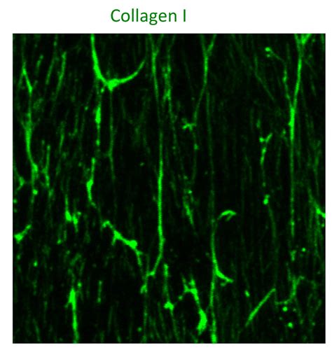 Human Collagen I alpha 1 Antibody AF6220: R&D Systems