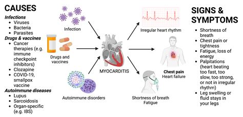 Myocarditis Center | UCSF Cardiology