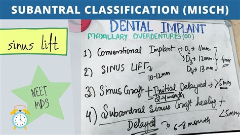 Understand maxillary overdenture with sinus lift procedure - YouTube