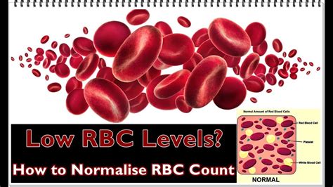 Low RBC Levels – Causes, Symptoms, Treatment - YouTube