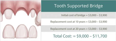 Cost Effectiveness | Oral Surgery in Omaha, NE