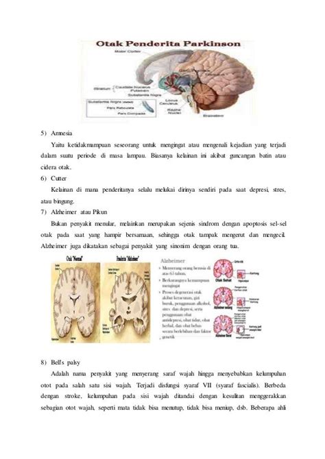 Sistem Saraf Otonom