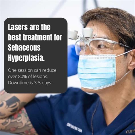 Best Sebaceous Hyperplasia Treatments In Australia