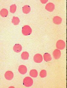 Haemobartonella - meddic