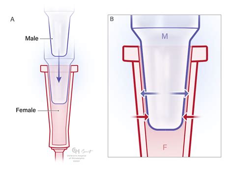 Managing Luer Connections | Anesthesia Experts