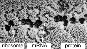 Ribosomes Electron Micrograph