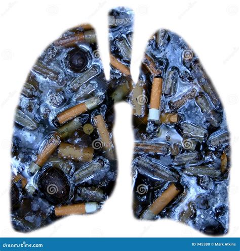 Smokers lungs stock photo. Image of effects, stop, anatomy - 945380