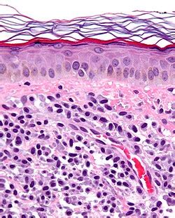 Mast Cells Histology