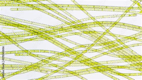 Spirogyra, a filamentous freshwater green algae with spiral arrangement ...