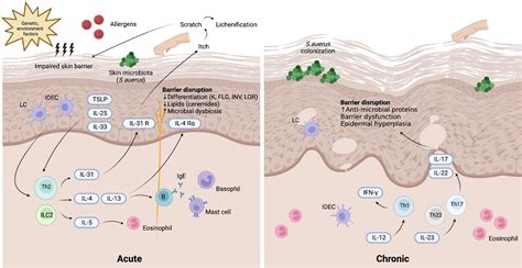 Atopic Dermatitis Pathway