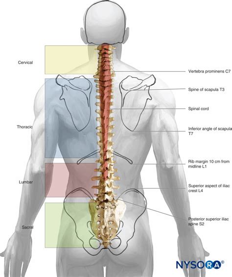 regional-anesthesia-skeletal-landmarks-used-to-determine-the-level-of-epidural-placement ...