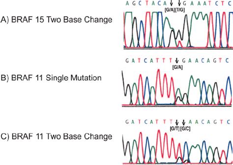 Sample electropherograms showing mutations in the BRAF gene. A,... | Download Scientific Diagram