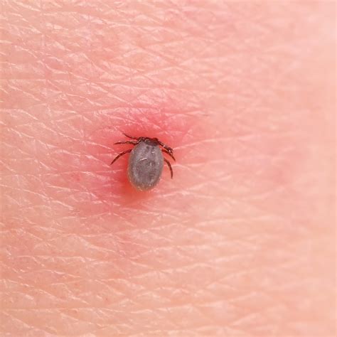 Ticks In The House | Renew Physical Therapy