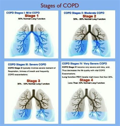 Medical and Health Science: Stages of COPD!!!