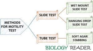 What is Motility Test? Definition, Purpose, Principle & Procedure ...