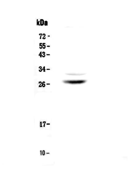 Myelin Protein Zero/MPZ Antibody