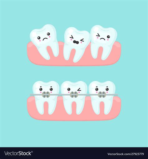 Braces alignment stomatology concept cute Vector Image