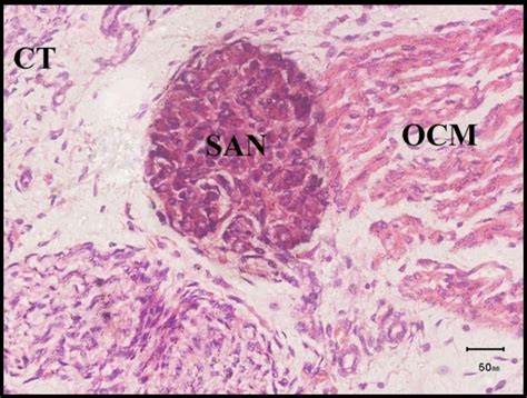 Figure 5 from Histology of Sinoatrial Node in the Dromedary Camel Foetus | Semantic Scholar