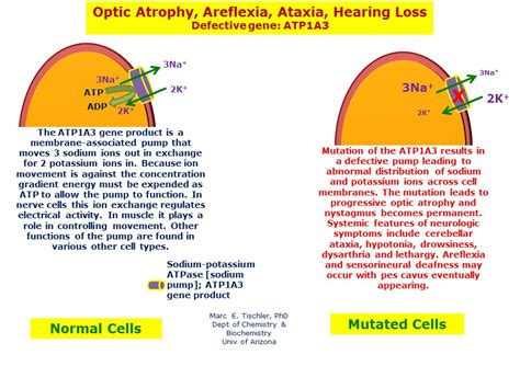 Optic Atrophy, Areflexia, Ataxia, Hearing Loss | Hereditary Ocular Diseases