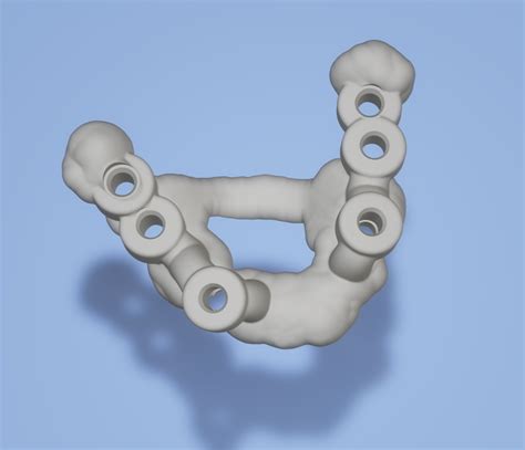 STL file Surgical guide dental implant 3・3D print model to download・Cults