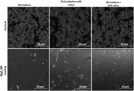 MgF2 nanoparticle-coated teeth inhibit Streptococcus mutans biofilm formation on a tooth model ...