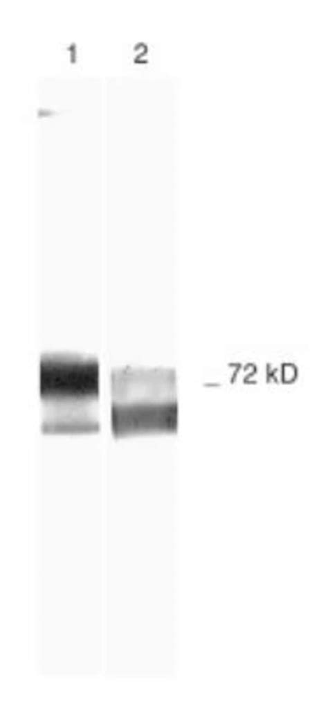 MMP-2 Antibody (2C1) - (Pro and Active) - BSA Free:Antibodies:Primary ...