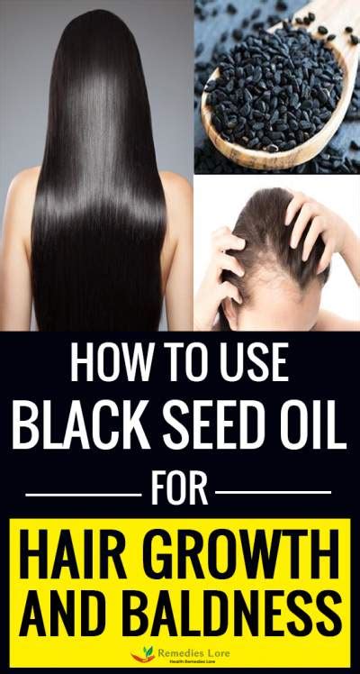 How to Use Black Seed Oil (Kalonji) For Hair Growth and Baldness? - Remedies Lore