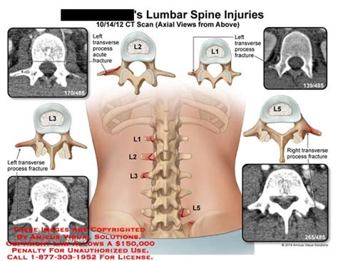 Medical Exhibits, Demonstrative Aids, Illustrations and Models