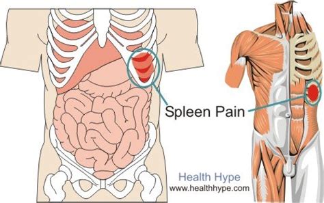 7 Signs of Spleen Problems (Acute and Chronic) | Healthhype.com