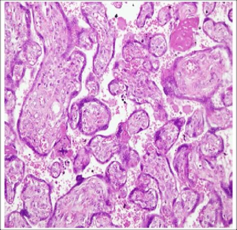 Placenta Histology Labeled