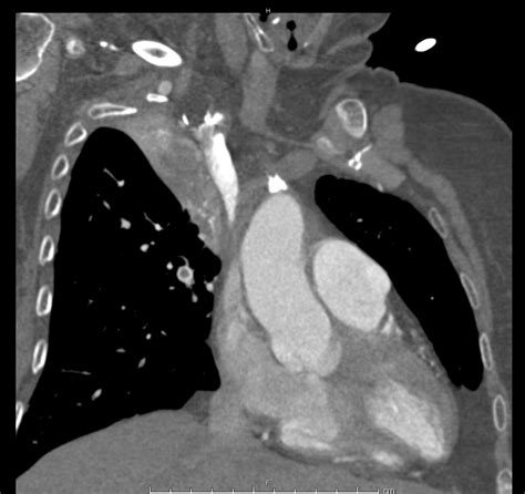 02_pe - Differential Diagnosis of