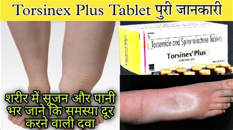 Torsinex Plus Tablet | Torasemide & Spironolactone Tablet | Uses | Dose ...