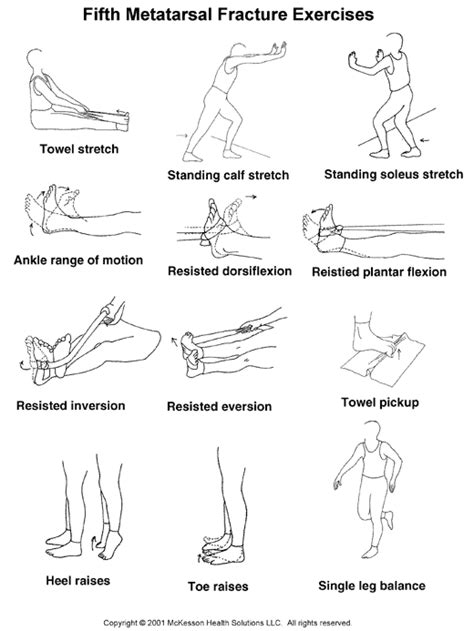 Sports Medicine Advisor 2003.1: Fifth Metatarsal Fracture Exercises: Illustration