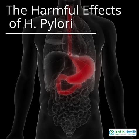 The Harmful Effects of H. Pylori | H. Pylori Causes Fatigue ﻿| Just In Health