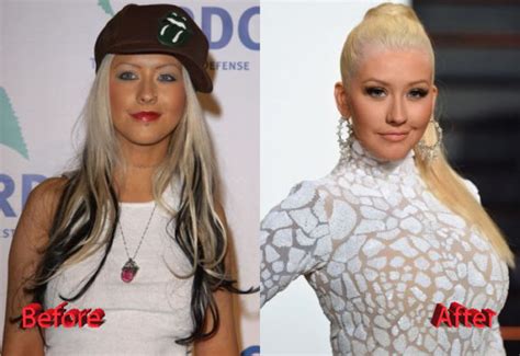 A Take on Christina Aguilera Plastic Surgery