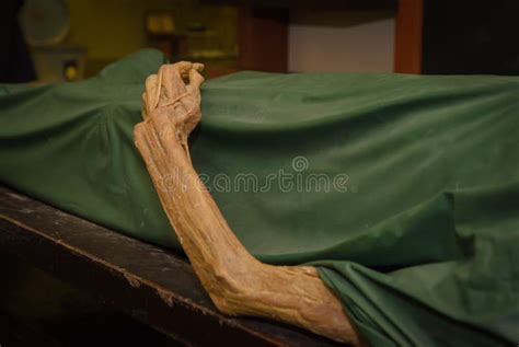 The Dead Body. Focus on Hand Decay Stock Photo - Image of person, pressure: 46224458