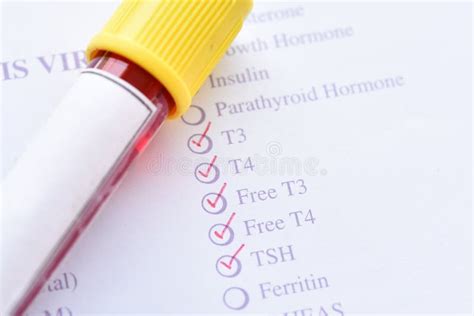 Thyroid hormone test stock image. Image of gland, research - 113572887